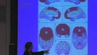 Lecture 06 Architecture of Cortex amp Going Beyond Primary Visual Cortex [upl. by Otrebron]