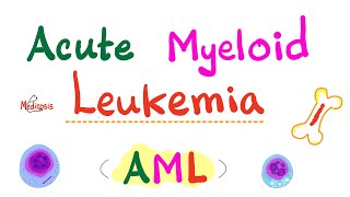 Acute Myeloid Leukemia AML  Auer Rods  Myeloperoxidase Positive  Hematology amp Oncology Series [upl. by Ccasi266]