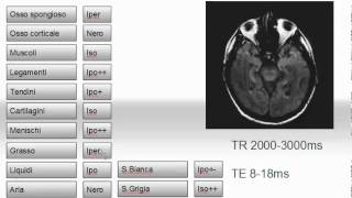 Semeiotica del segnale in risonanza magnetica 27 [upl. by Etnaik]