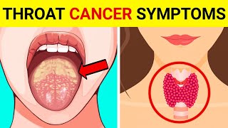 Throat Cancer  Signs And Symptoms of Throat Cancer   Throat Cancer Symptoms [upl. by Bear]