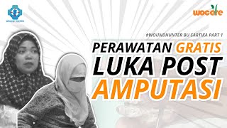 PERAWATAN LUKA POST OPERASI DENGAN CSWD  PERAWATAN LUKA GRATIS BY WOUND HUNTER [upl. by Dasie]