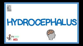 Hydrocephalus Hydrodynamic CSF disorder [upl. by Mulcahy]