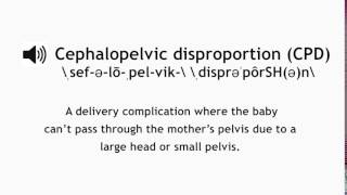 How to Pronounce Cephalopelvic Disproportion CPD [upl. by Aynav173]