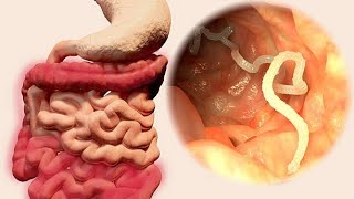 Nematode Navigations A Dive into Gastrointestinal Parasites 4 Minutes [upl. by Eiramit]