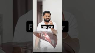 Fatty liver घर के खाने की ताकत को पहचानो drrobin health food ayurved doctor facts remedy [upl. by Darach532]