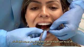 STEP BY STEP Articulator mounting Arabic Version [upl. by Enyrb]