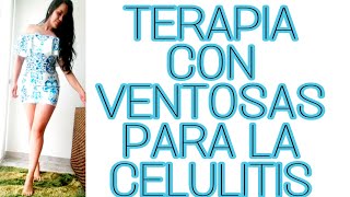 Terapia con ventosas para la celulitis en casa [upl. by Ynetruoc]