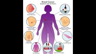 breast cancer part 1 [upl. by Leanatan213]