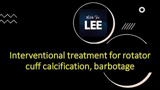 Interventional treatment for the rotator cuff calcification barbotage treatment series part 1 [upl. by Joannes787]