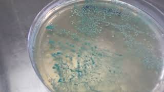 Candida albican on candida deferential agar plate  Budding yeast [upl. by Bern]