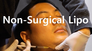 Nonsurgical Liposuction Fat Dissolving Injections in Korea  Seoul Guide Medical [upl. by Atteragram]