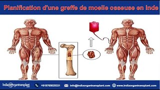 Planification dune greffe de moelle osseuse en Inde  Services de transplantation dorganes en Inde [upl. by Iveksarap604]