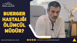 Buerger Hastalığı Ölümcül müdür  Buerger Hastalığı Tedavisi var mı [upl. by Einnalem976]