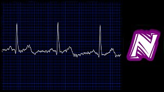 Sonido de monitor cardiaco  Heart monitor sound effect  Ekg sound  Sonido electrocardiograma [upl. by Assecnirp]