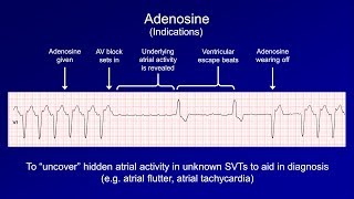 Antiarrhythmics Lesson 6  Digoxin Adenosine Atropine Isoproterenol and Ivabradine [upl. by Nnyled]