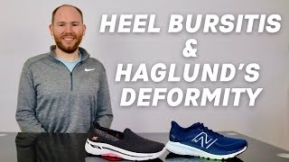 Best Shoes for Haglunds Deformity and Retrocalcaneal Bursitis  Shoes for Heel Bursitis [upl. by Encrata]