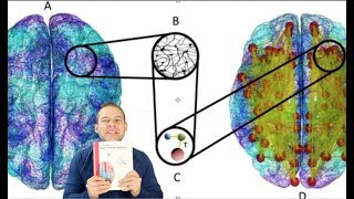 The Brain Connectome Explained Through Graph Theory Neurofeedback Implications [upl. by Morrissey]