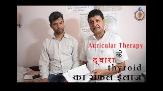 ऑरिकुलर थेरेपी के द्वारा थायराइड का सफल इलाज  Thyroid [upl. by Ardnekal]