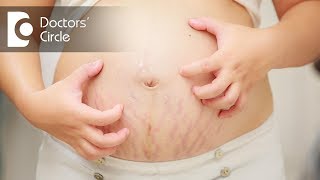 How to manage pregnancy rashes  Dr Tina Ramachander [upl. by Jaenicke]