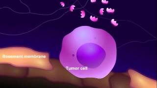 Introduction to Cancer Biology Part 3 Tissue Invasion and Metastasis [upl. by Allemat]