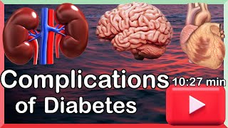 Video 7 ׀ Complications of chronic Diabetes Mellitus ׀ Macrovascular vs Microvascular  dr joos [upl. by Aicilihp331]