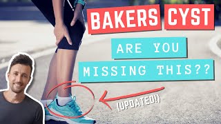 BAKERS CYST Exercises You Should Be Doing Updated [upl. by Dnalel13]