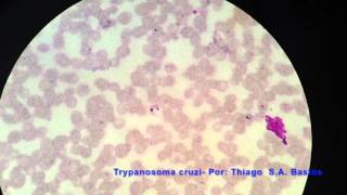 Trypanosoma cruzi [upl. by Schlessel]