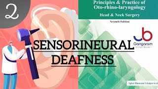 SENSORINEURAL DEAFNESS PART2 ENT LECTURES [upl. by Nnaeus]