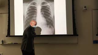 Chest xray positioning [upl. by Pettit]