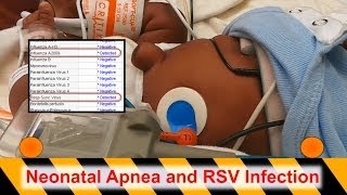 Neonatal Apnea and RSV Infection [upl. by Hallette]