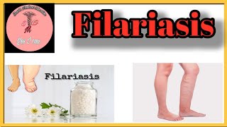 Filariasis l Causes l Sign amp Symptoms l Management [upl. by Caleb]