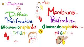 Diffuse Proliferative Glomerulonephritis vs Membranoproliferative Glomerulonephritis  DPGN vs MPGN [upl. by Mayram]