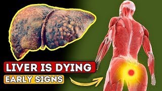 Liver Damage Alert Watch Out for These 10 Warning Signs [upl. by Lahtnero]