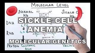 Sickle cell anemia  causes symptoms diagnosis treatment amp pathology [upl. by Ariad829]