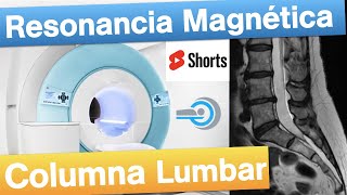 Resonancia Magnética 🧲 Lumbar dolordeespalda radiologia herniadedisco 👇 [upl. by Ohnuj]