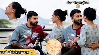 real chickenPox🥺 prank  gone extremely emotional 😭  veer Samrat vlog [upl. by Akkina113]