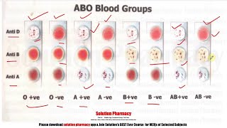 Blood Group Test  Determination of Blood Group  All Blood Group  Testing Blood Group  ENGLISH [upl. by Ramhaj]