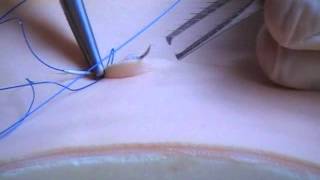 Subcuticular Suture Technique [upl. by Tengdin]