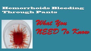 Hemorrhoid Bleeding Through Pants [upl. by Odin]