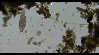 Cyanobacteria added to an Anaerobic sample of soil in a jar with water [upl. by Persis]