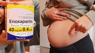 18 Week Pregnancy Update Im getting induced [upl. by Huntington]