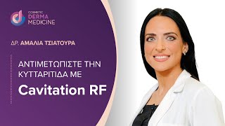 Αντιμετωπίστε την κυτταριτιδα με Cavitation RF [upl. by Marmaduke]