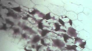 Onion Cell Plasmolysis [upl. by Ellegna]