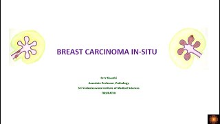 BREAST CARCINOMA INSITU [upl. by Naneik19]