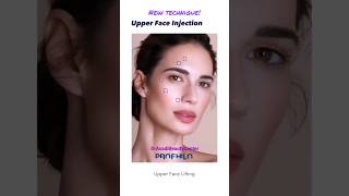 PROFHILO Skin Booster Elevation BAP Technique UpperLower Facelift Rejuvenation shorts profhilo [upl. by Banerjee]