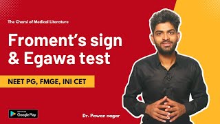 Froments sign and Egawa test  FMGE NEET PG INICET [upl. by Fruin]