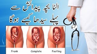 How to turn breech baby into head down  Ulta bacha sidha Drmrssaeed [upl. by Maxfield]