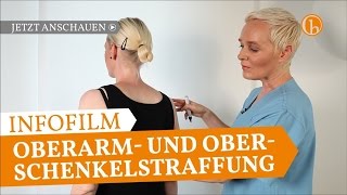 Oberarm amp Oberschenkelstraffung  Erfahrungsbericht  Dr Simone Hellmann Plastische Chirurgie Köln [upl. by Euqinoj195]