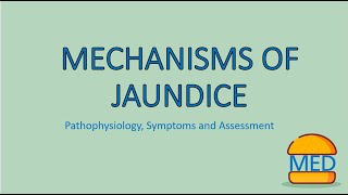 JAUNDICE MADE EASY  Mechanism Pathophysiology and Assessment [upl. by Broddie552]