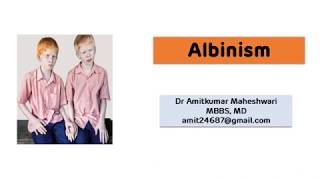 Albinism  Deficiency of Tyrosinase [upl. by Derwon]